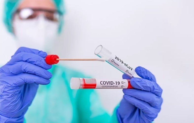 Заболеваемость COVID-19 в Кировской области снизилась до 74 случаев в сутки