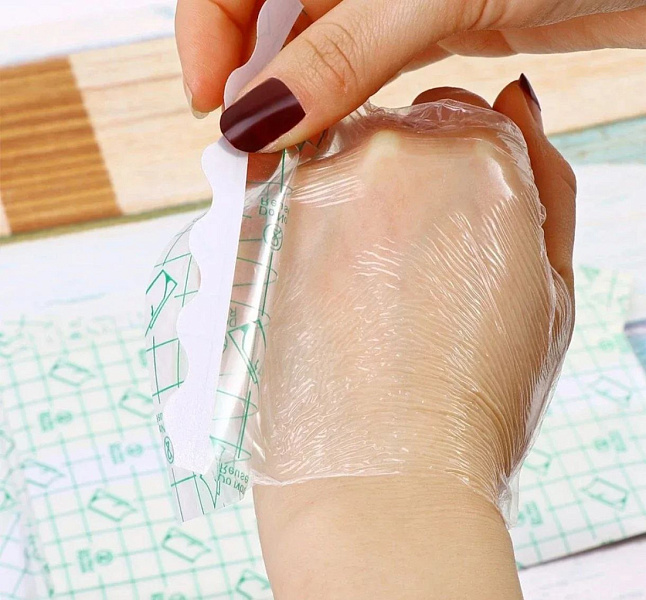 В Кирове разработали медицинскую пленку, заменяющую бинты